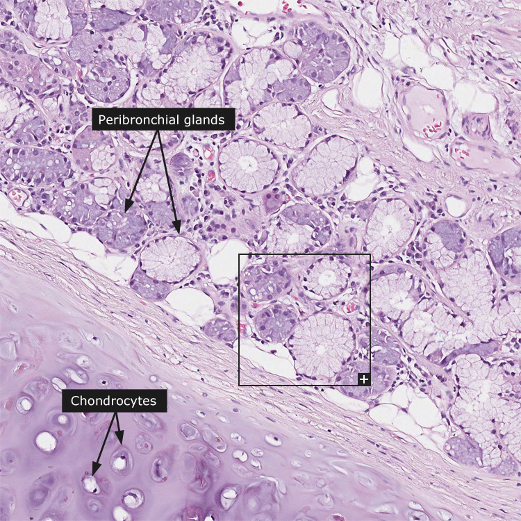 Dictionary Normal Bronchus The Human Protein Atlas