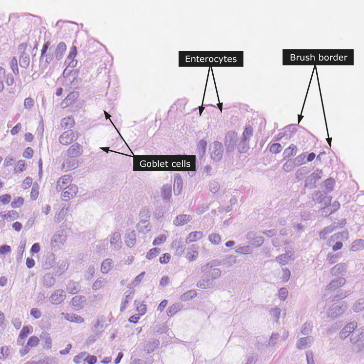 Dictionary Normal Colon The Human Protein Atlas