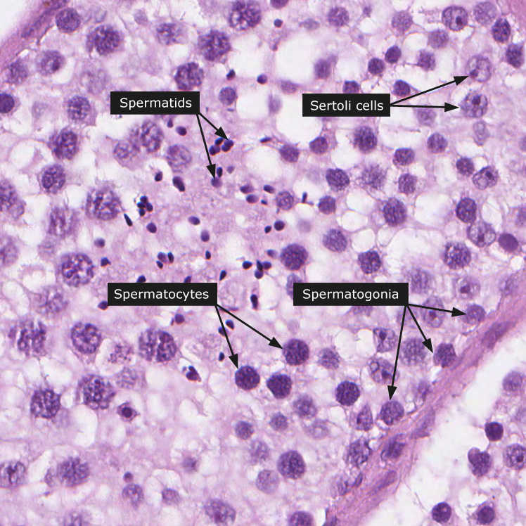 Dictionary - Normal: Testis - The Human Protein Atlas