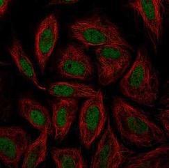 IF_SNAI1 SiHa HPA056831.jpeg